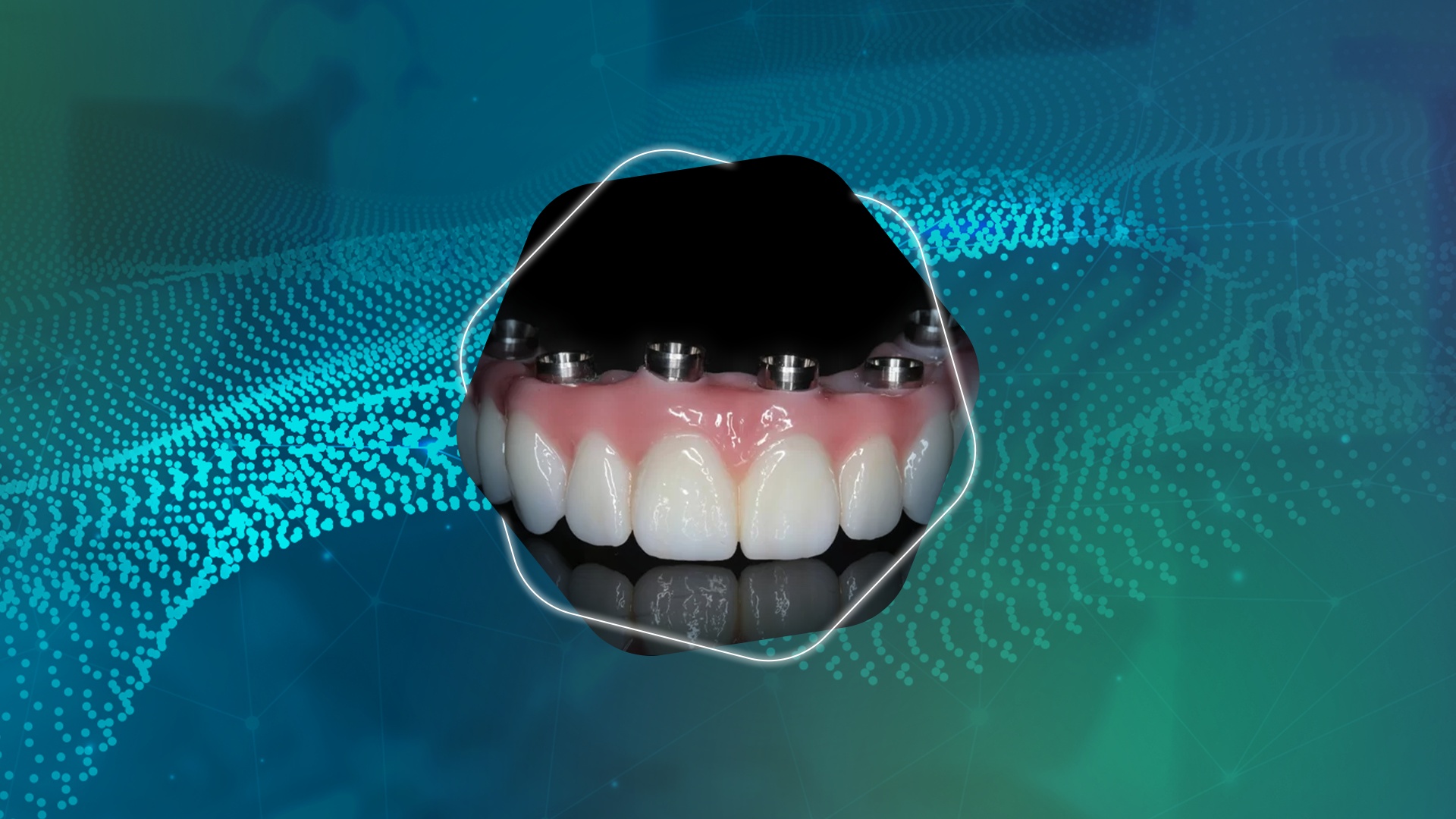 11374918866 ESPECIALIZAÇÃO EM PRÓTESE DENTÁRIA PROF VINÍCIUS PORTO Banner site